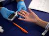 Acupuncture therapy may help prevent diabetes
