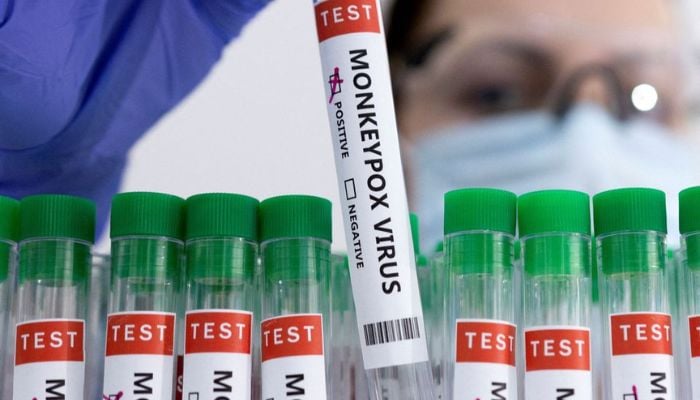 Test tubes labelled Monkeypox virus positive are seen in this illustration taken May 23, 2022. Photo: Reuters