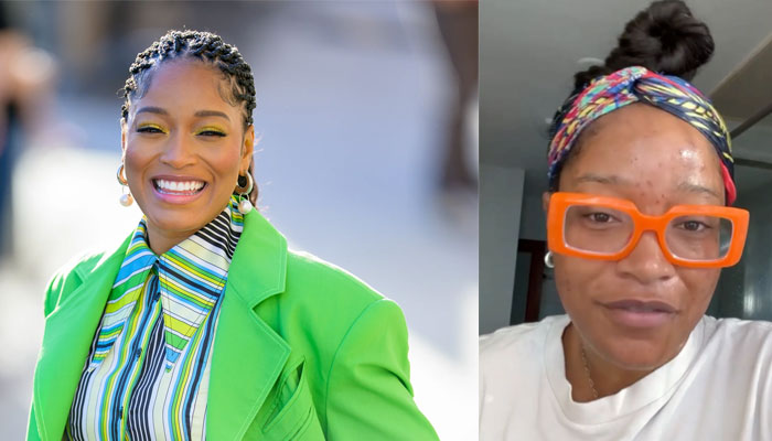 Keke Palmer mocks plastic surgeons over finding ‘quick fix’ for adult acne: Watch
