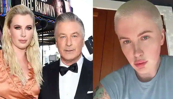 Ireland Baldwin reveals why she ‘feels’ more beautiful than ever: Photos