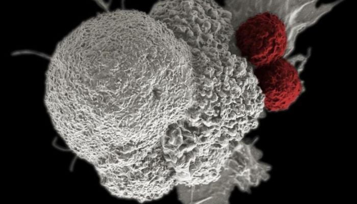 An oral squamous cancer cell (white) being attacked by two cytotoxic T cells (red), part of a natural immune response. — Reuters