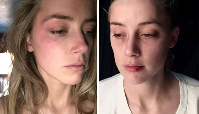 Amber Heard’s PR team gets emails leaked: ‘Phots of bruises are fake’