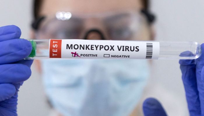 Test tubes labelled Monkeypox virus positive are seen in this illustration taken May 23, 2022.