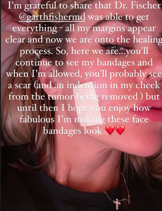 Khloé Kardashian opens up about her recent skin cancer scare