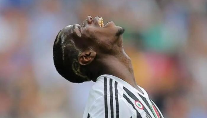 Piala Dunia Pogba berisiko cedera paha: laporan