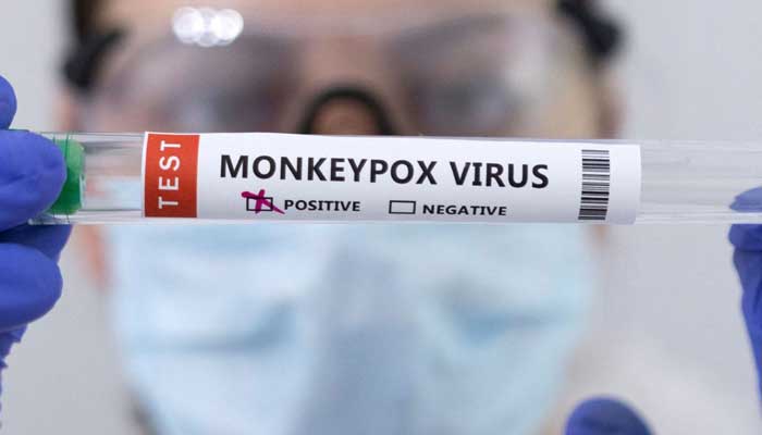 The number of new global cases of monkeypox fell by 41% in the seven days up to Monday compared to the previous week, the WHO said. — Reuters