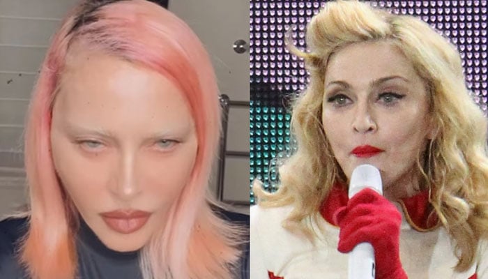 Madonna Looks 'Unrecognizable' Now—A Plastic Surgeon Weighs In: 'At Least  12 Cosmetic Procedures