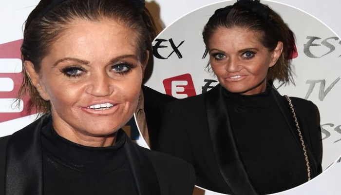 Danniella Westbrook ready to fly abroad for another TWO face surgeries