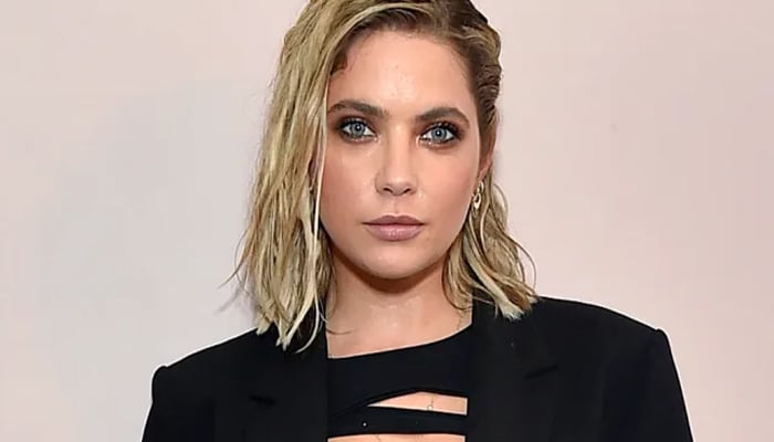 Ashely Benson shares about her anxiety-inducing skin condition