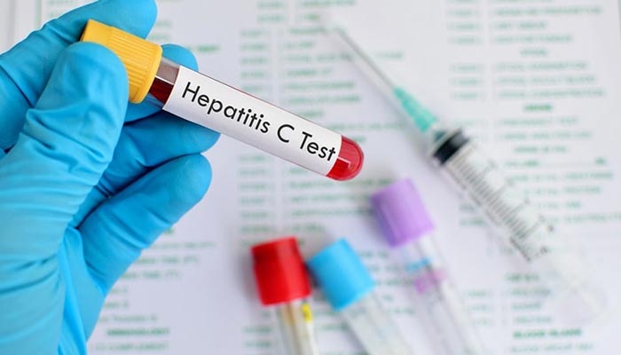 Blood sample for hepatitis C virus testing — AFP/File