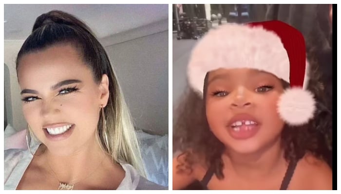 Khloe Kardashian’s daughter True looks sweet with her first broken tooth