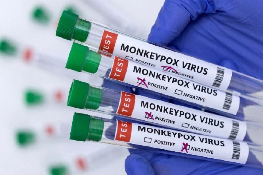 Test tubes labelled Monkeypox virus positive and negative are seen in this illustration taken May 23, 2022. — Reuters