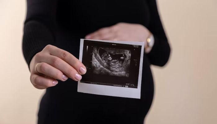 Cropped image of young pregnant woman holding ultrasound picture on belly.— Unsplash