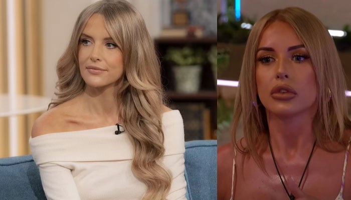 Love Island star Faye Winter reveals she dissolved her lip fillers as they made her look silly on the show
