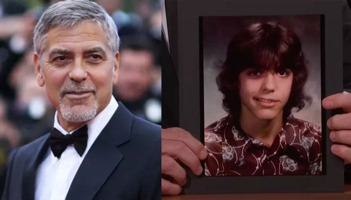 George Clooney reveals he was diagnosed with Bells Palsy as a teenager