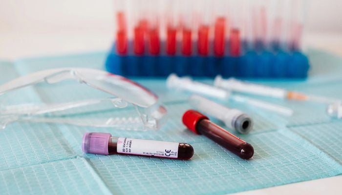 Full vials of blood near various medical equipment for taking blood.— Pexels