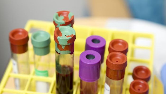 Image shows several lab tubes of blood.— Unsplash