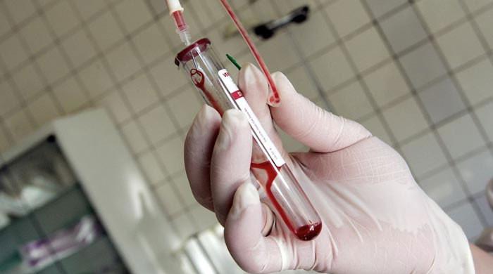 Pakistan sees 70% rise in HIV cases in past seven years Pakistan sees 70% rise in HIV cases in past seven years
