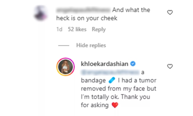 Khloé Kardashian shares health update after tumor removal from her face