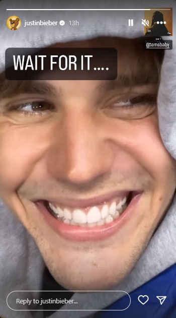 Justin Bieber membagikan pembaruan langka tentang kelumpuhan wajah Ramsay Hunt