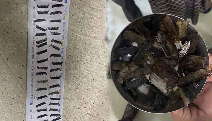 The picture shows razor blades taken out from the mans stomach. — NDTV
