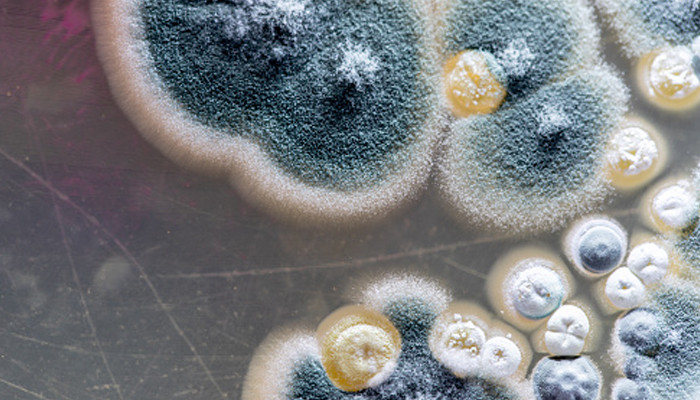 Deadly fungus Candida auris on the spread in US