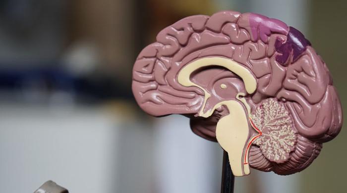 Eyes can help identify people with Alzheimer's disease, study