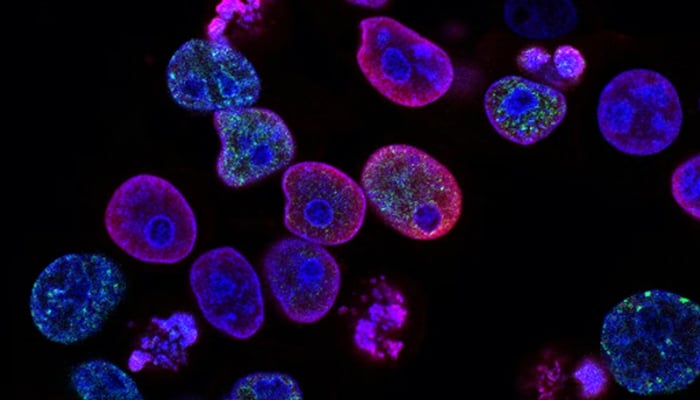 A representational image of cancer cells. — Unsplash/File