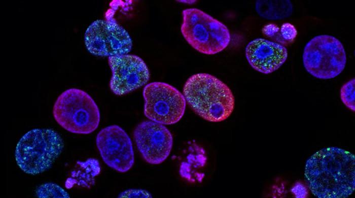 Scientists continue debate on finding causes for colon cancer