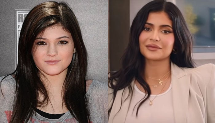 Kylie Jenner mocked over claims about plastic surgery