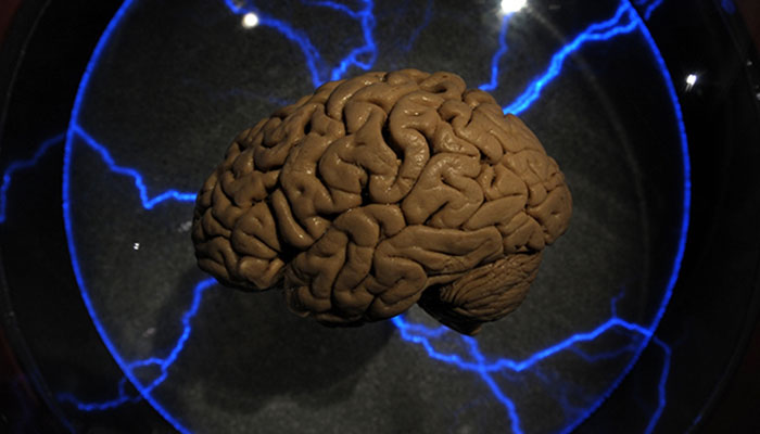A representational image of a human brain. — AFP/File