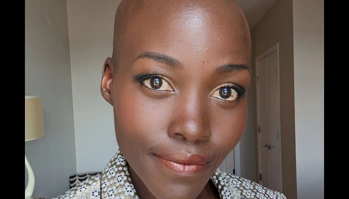 Lupita Nyong’o reveals stunning new buzzcut on Instagram