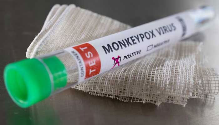 Test tube labelled Monkeypox virus positive are seen in this illustration taken May 22, 2022. — AFP