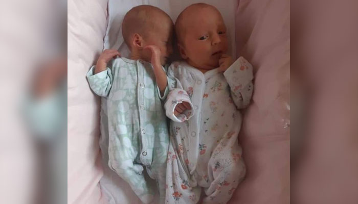 Seorang wanita mengandung anak kembar dengan jarak empat minggu