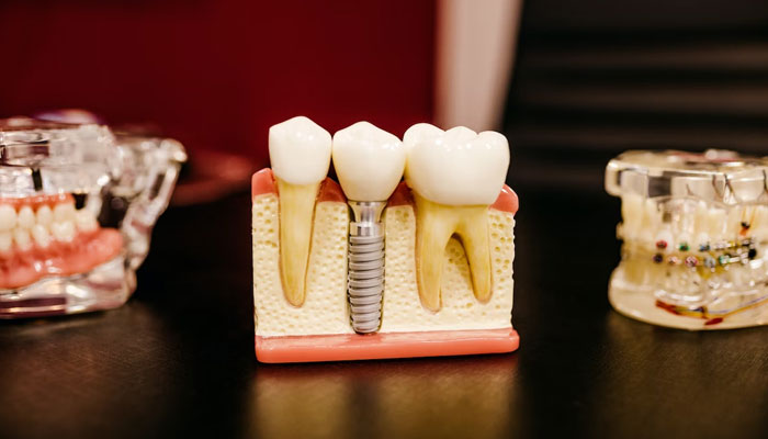 This image shows artificial human teeth.  - unsplash /file