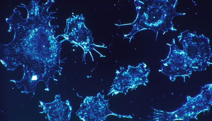 A representational image of prostate cancer cells. — Pixabay/File
