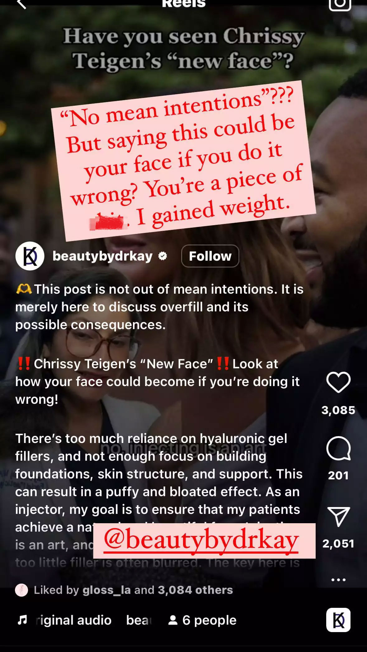 Chrissy Teigen claps back at haters criticizing her ‘new face’ after weight gain