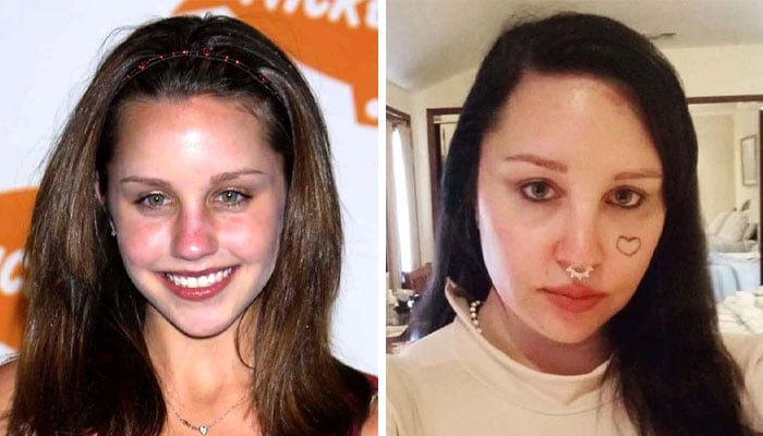 Amanda Bynes called the cops herself for her second psychiatric hold