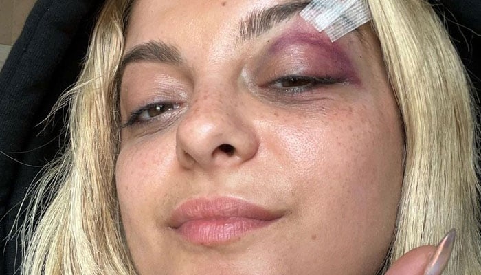 Bebe Rexha thanked her fans for their support