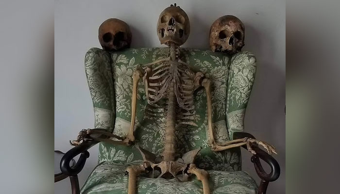 The picture shows human skeleton and skulls. — Facebook/WilliamBurke