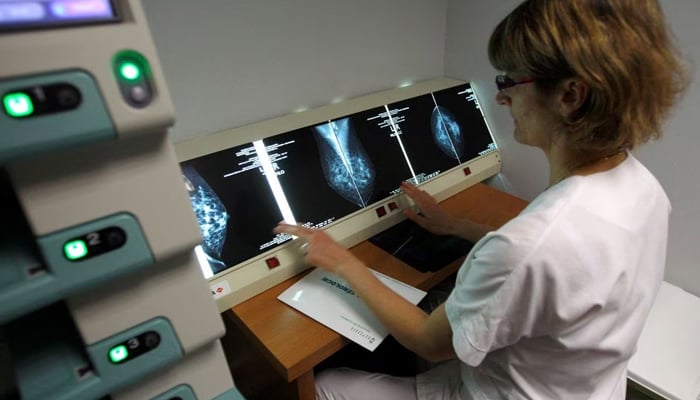 A radiologist examines breast X-rays after a cancer prevention medical check-up at the Ambroise Pare hospital in Marseille, southern France. — Reuters/File