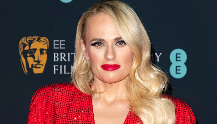 Rebel Wilson had to get stiches after accident during the filming of Bride Hard