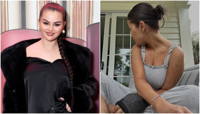 Selena Gomez injured her arm when she tripped while walking from her car to her house