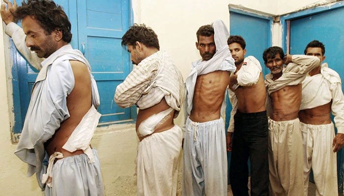 Men reveal scars where their kidneys were removed at a police station in Lahore in 2017. — AFP