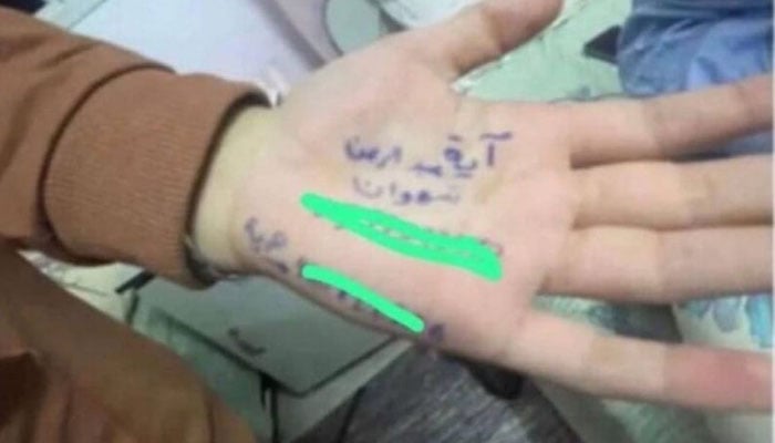Heartwrenching reason why Gaza children write their names on wrists.—X@AmerZehr