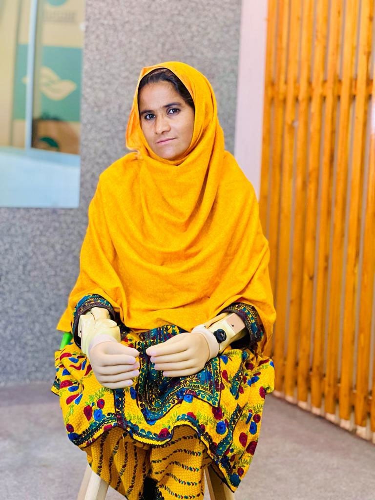 Allah Bachai, a farming lady from Sohbatpur District in Balochistan, poses for photos wearing AI-driven artificial limbs she received from Bioniks. — Photo by Bioniks