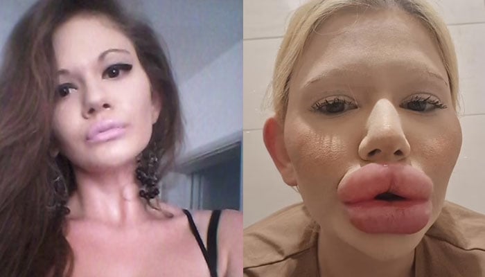 Andrea Ivanova before having any lip filler, a far cry away from her current face, she is seen sporting a baby pink lip and cat eye.—Jam Press@andrea88476