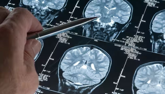In this undated photo, a scientist is examining an MRI of the human brain. — AFP/File