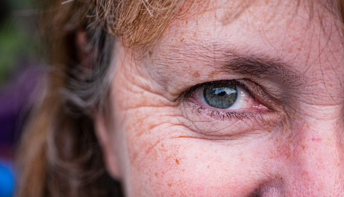 A woman with wrinkles around her eyes. — Unsplash