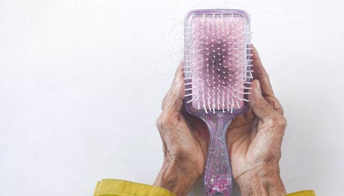 An individual holding a hair brush with fallen hair stuck in it. — Unsplash